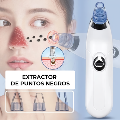 Extractor de Puntos Negros