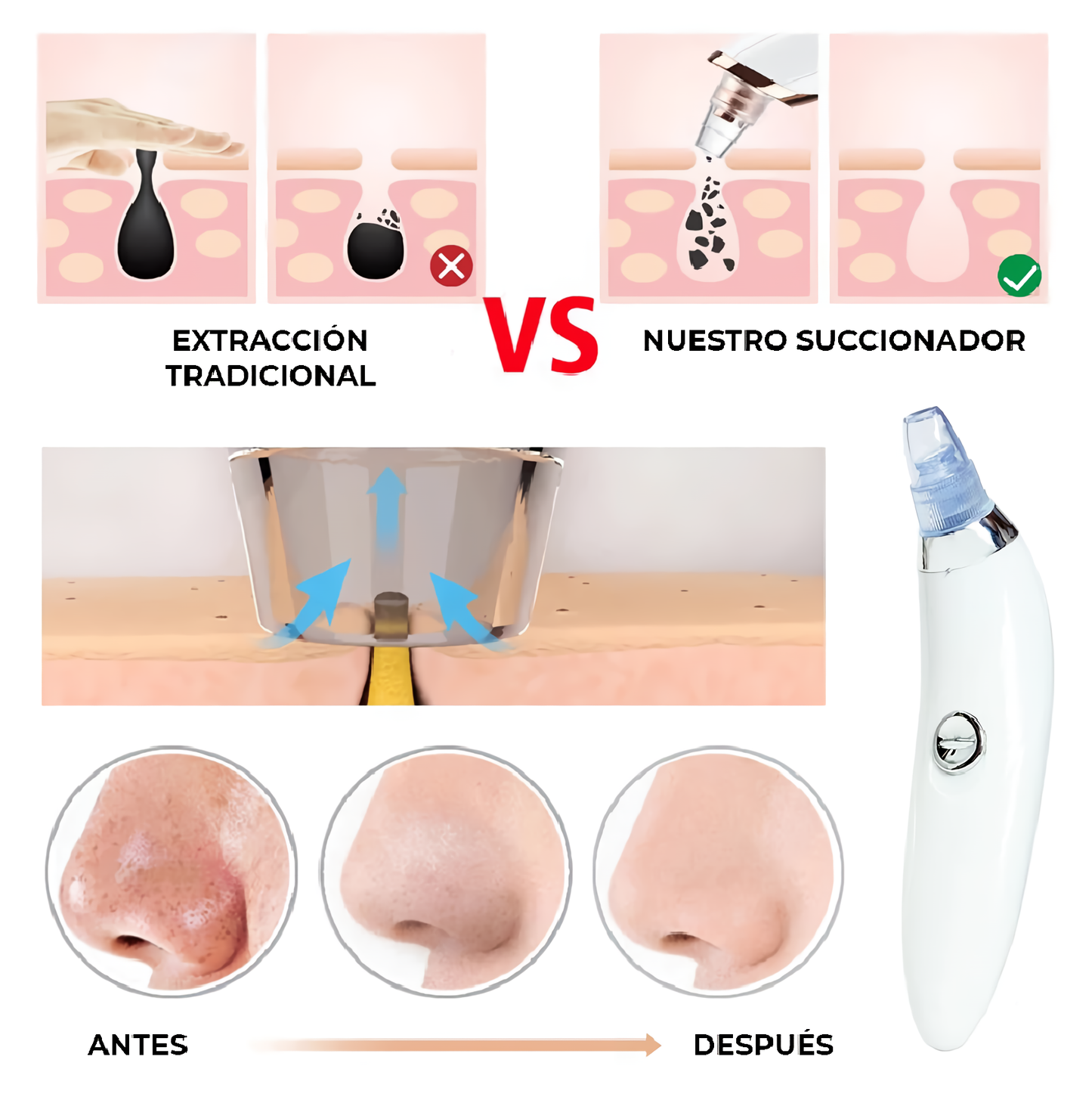 Extractor de Puntos Negros