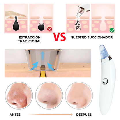 Extractor de Puntos Negros